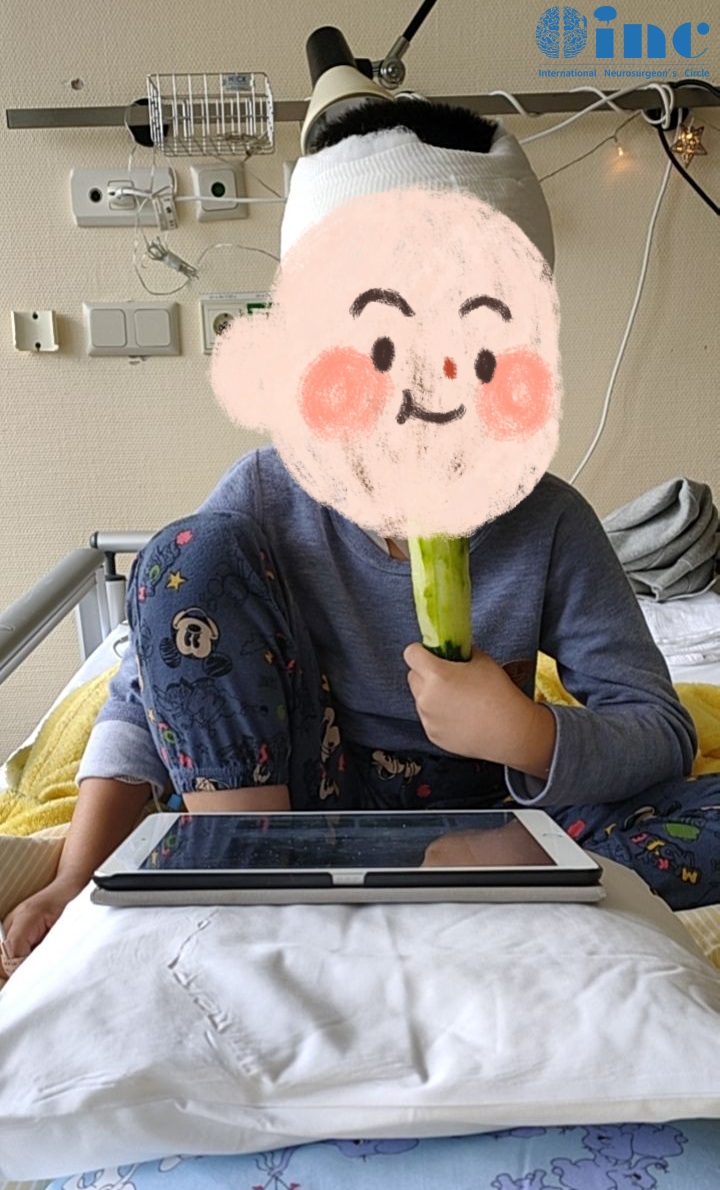 儿童胶质瘤术后