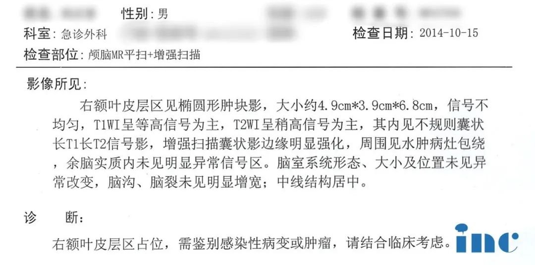 巨大胶质瘤术后3年竟可以行云流水打八段锦！