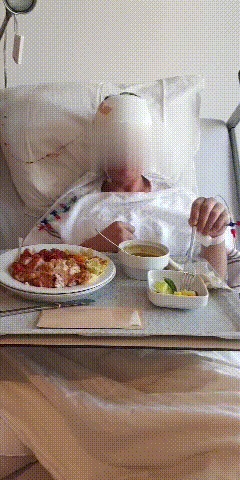 脑干-顶盖胶质瘤饮食