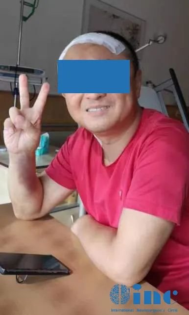 术后六天顾先生恢复良好，脸上绽放出灿烂的笑容