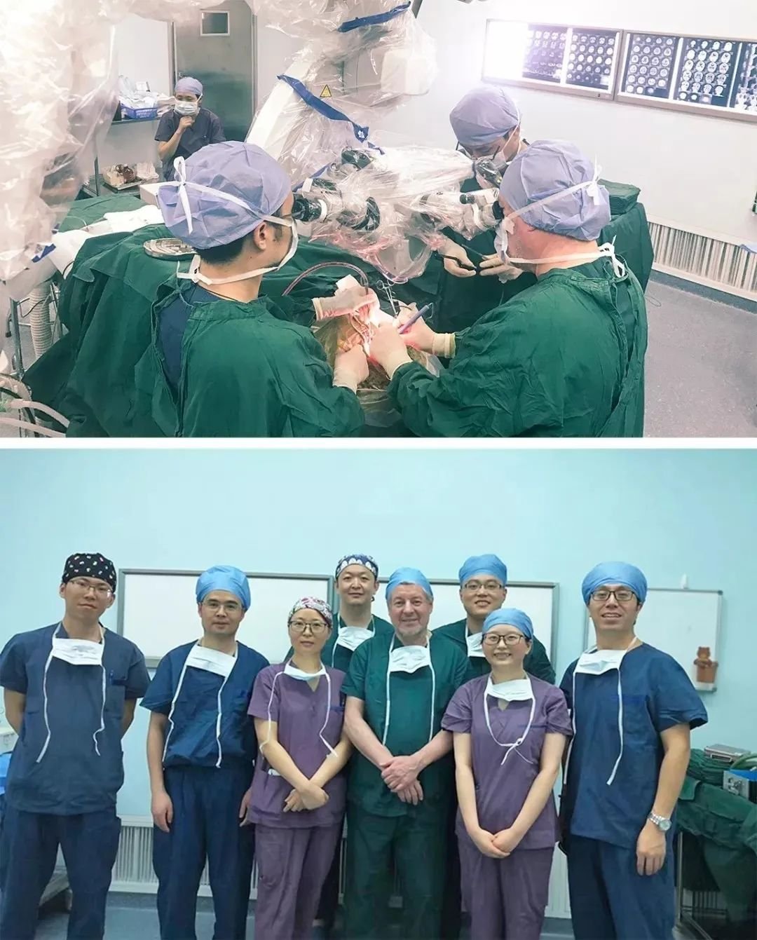 5岁儿童脊髓-脑干<a href='/jibing/naojiaozhiliu/1803.html' target='_blank'><u>胶质瘤手术</u></a>