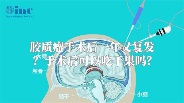 胶质瘤手术后一年又复发？手术后可以吃干果吗？