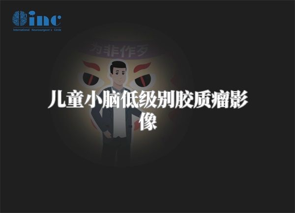 儿童小脑低级别胶质瘤影像