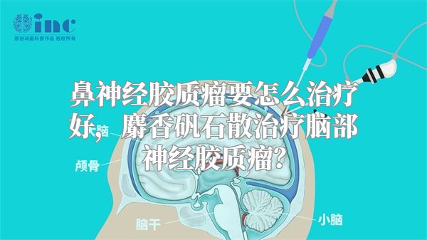 鼻神经胶质瘤要怎么治疗好，麝香矾石散治疗脑部神经胶质瘤？
