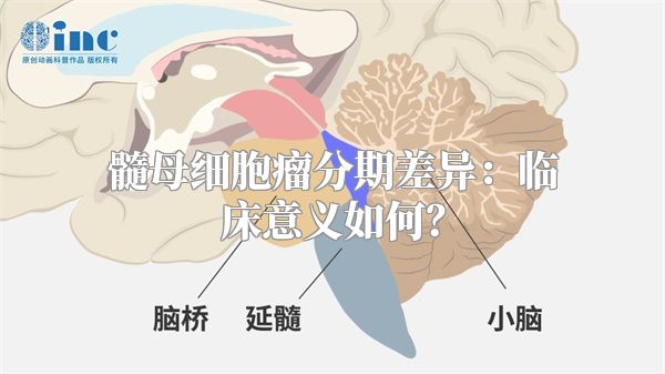 髓母细胞瘤分期差异：临床意义如何？