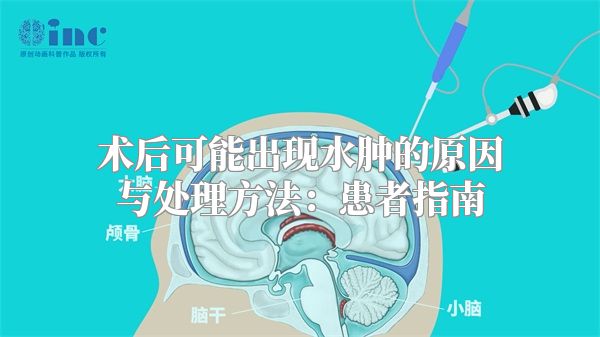 术后可能出现水肿的原因与处理方法：患者指南