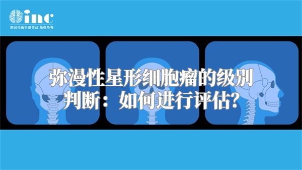 弥漫性星形细胞瘤的级别判断：如何进行评估？