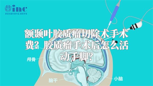 额颞叶胶质瘤切除术手术费？胶质瘤手术后怎么活动手脚？
