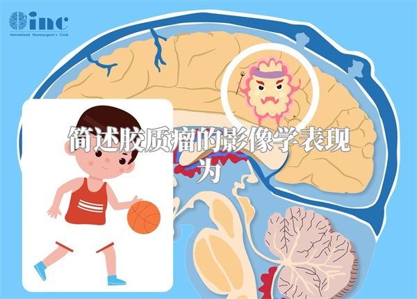 简述胶质瘤的影像学表现为
