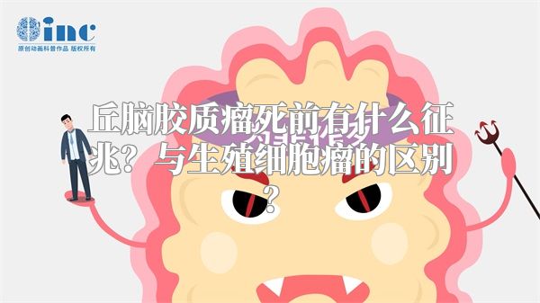 丘脑胶质瘤死前有什么征兆？与生殖细胞瘤的区别？