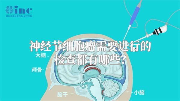 神经节细胞瘤需要进行的检查都有哪些？