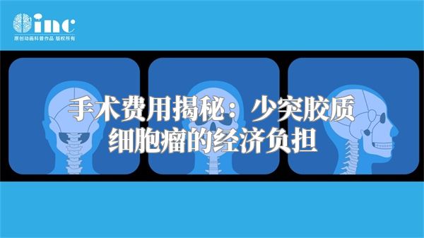 手术费用揭秘：少突胶质细胞瘤的经济负担