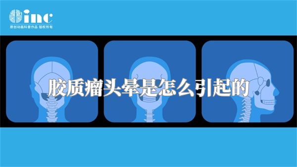 胶质瘤头晕是怎么引起的