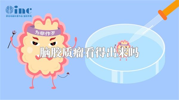 脑胶质瘤看得出来吗