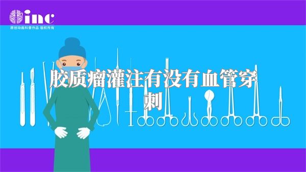 胶质瘤灌注有没有血管穿刺