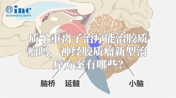 质子重离子治疗能治胶质瘤吗，神经胶质瘤新型治疗方案有哪些？