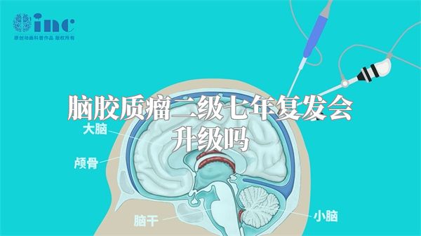 脑胶质瘤二级七年复发会升级吗