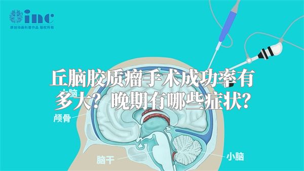 丘脑胶质瘤手术成功率有多大？晚期有哪些症状？
