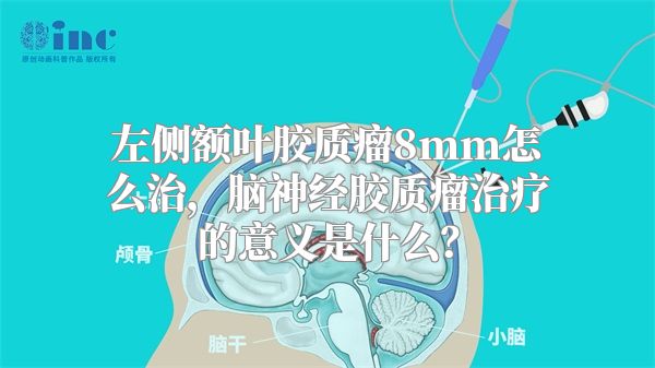 左侧额叶胶质瘤8mm怎么治，脑神经胶质瘤治疗的意义是什么？