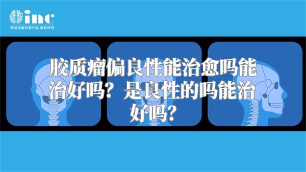 胶质瘤偏良性能治愈吗能治好吗？是良性的吗能治好吗？