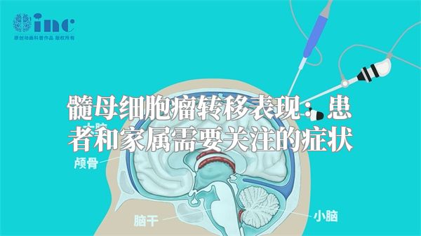 髓母细胞瘤转移表现：患者和家属需要关注的症状