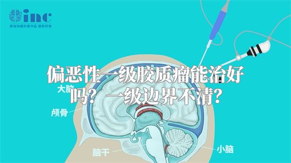 偏恶性一级胶质瘤能治好吗？一级边界不清？