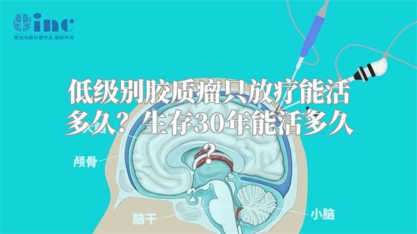 低级别胶质瘤只放疗能活多久？生存30年能活多久？