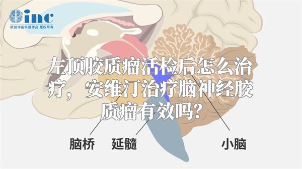 左顶胶质瘤活检后怎么治疗，安维汀治疗脑神经胶质瘤有效吗？