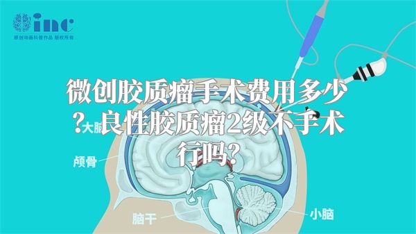 微创胶质瘤手术费用多少？良性胶质瘤2级不手术行吗？