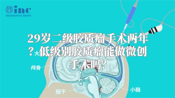 29岁二级胶质瘤手术两年？低级别胶质瘤能做微创手术吗？