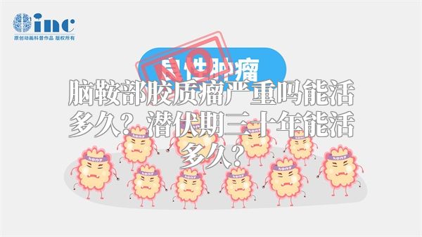 脑鞍部胶质瘤严重吗能活多久？潜伏期三十年能活多久？