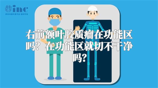 右前额叶胶质瘤在功能区吗？在功能区就切不干净吗？