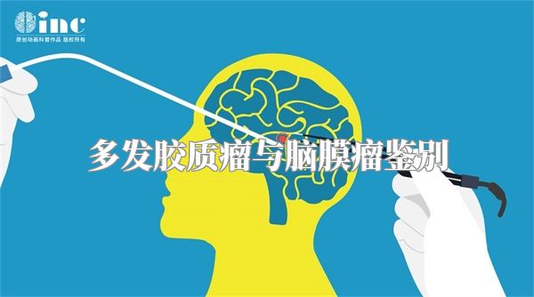 多发胶质瘤与脑膜瘤鉴别