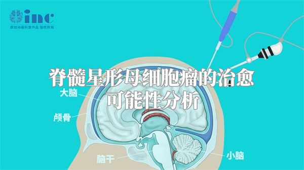 脊髓星形母细胞瘤的治愈可能性分析