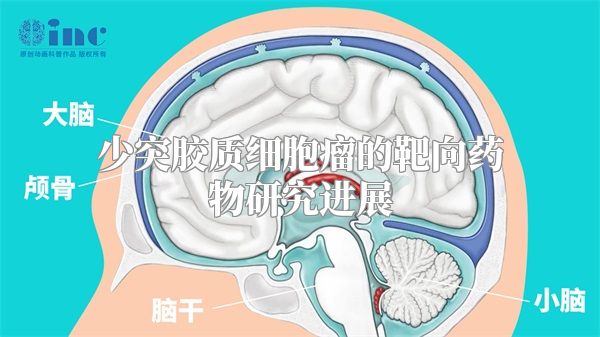 少突胶质细胞瘤的靶向药物研究进展