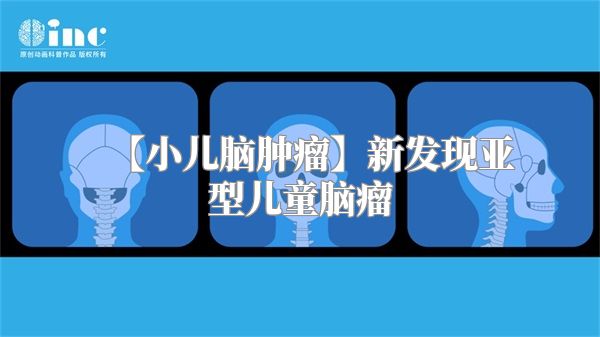 【小儿脑肿瘤】新发现亚型儿童脑瘤