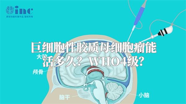 巨细胞性胶质母细胞瘤能活多久？WHO4级？