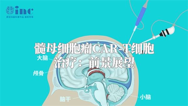 髓母细胞瘤CAR-T细胞治疗：前景展望