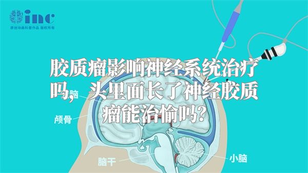 胶质瘤影响神经系统治疗吗，头里面长了神经胶质瘤能治愉吗？
