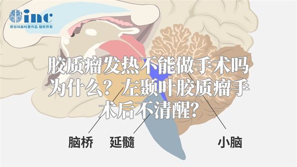 胶质瘤发热不能做手术吗为什么？左颞叶胶质瘤手术后不清醒？