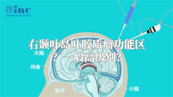 右颞叶岛叶胶质瘤功能区？一般高级别？