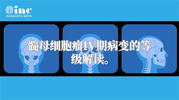 髓母细胞瘤IV期病变的等级解读。