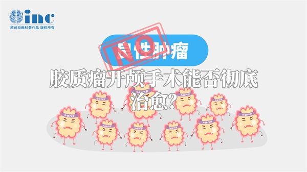 胶质瘤开颅手术能否彻底治愈？