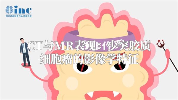 CT与MR表现：少突胶质细胞瘤的影像学特征