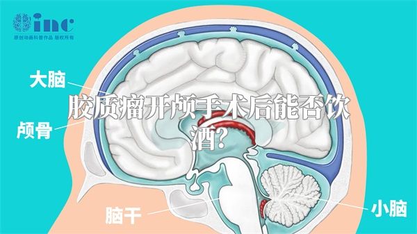 胶质瘤开颅手术后能否饮酒？