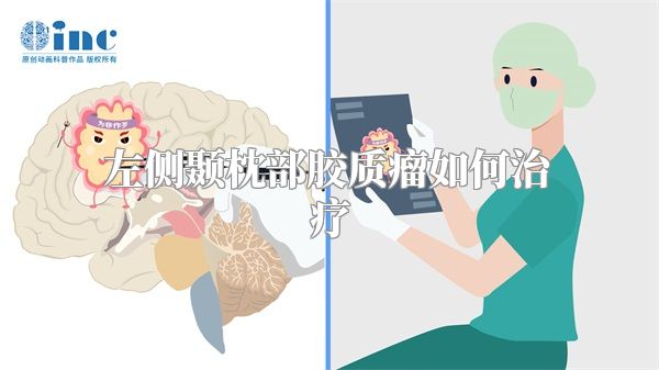 左侧颞枕部胶质瘤如何治疗