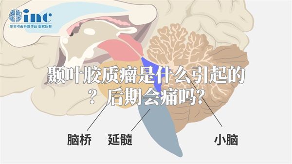 颞叶胶质瘤是什么引起的？后期会痛吗？