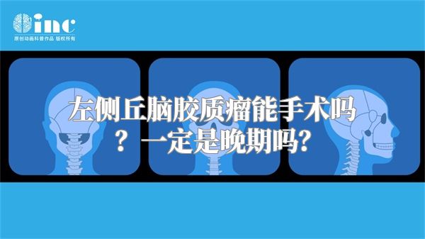 左侧丘脑胶质瘤能手术吗？一定是晚期吗？