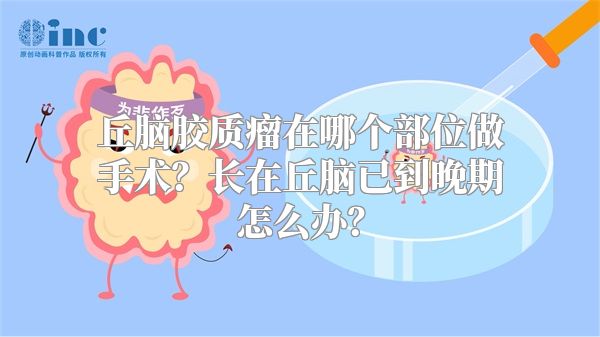 丘脑胶质瘤在哪个部位做手术？长在丘脑已到晚期怎么办？
