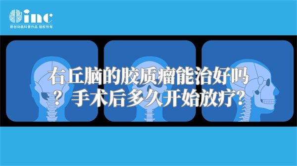 右丘脑的胶质瘤能治好吗？手术后多久开始放疗？